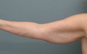 Before & After Pictures in Nashville, TN