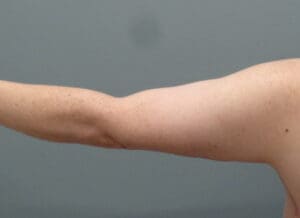 Before & After Pictures in Nashville, TN