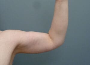 Before & After Pictures in Nashville, TN