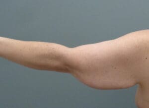 Before & After Pictures in Nashville, TN