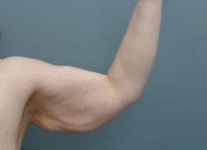 Before & After Pictures in Nashville, TN