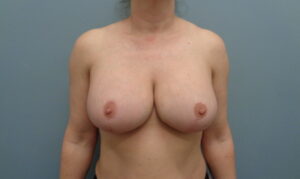 Before & After Pictures in Nashville, TN