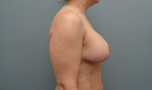 Before & After Pictures in Nashville, TN