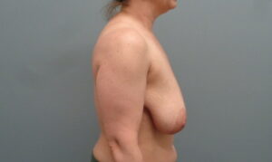 Before & After Pictures in Nashville, TN