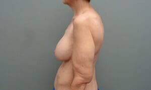 Before & After Pictures in Nashville, TN