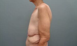 Before & After Pictures in Nashville, TN