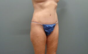 Before & After Pictures in Nashville, TN
