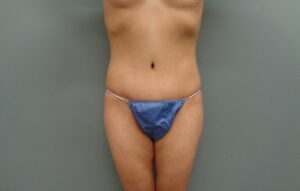 Before & After Pictures in Nashville, TN