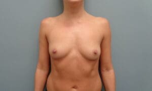 Before & After Pictures in Nashville, TN