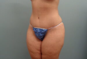 Before & After Pictures in Nashville, TN