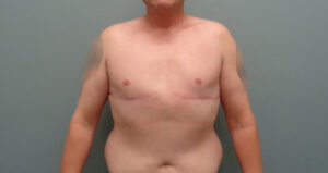 Before & After Pictures in Nashville, TN