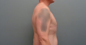Before & After Pictures in Nashville, TN