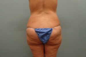 Before & After Pictures in Nashville, TN
