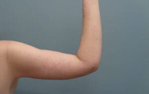 Before & After Pictures in Nashville, TN