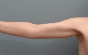 Before & After Pictures in Nashville, TN