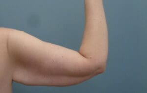 Before & After Pictures in Nashville, TN