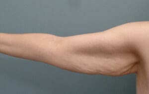 Before & After Pictures in Nashville, TN