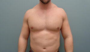 Before & After Pictures in Nashville, TN