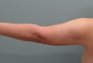 Before & After Pictures in Nashville, TN