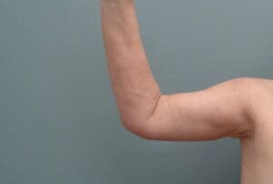 Before & After Pictures in Nashville, TN