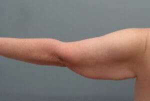 Before & After Pictures in Nashville, TN