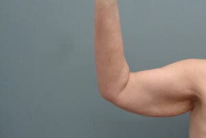 Before & After Pictures in Nashville, TN