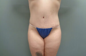 Before & After Pictures in Nashville, TN