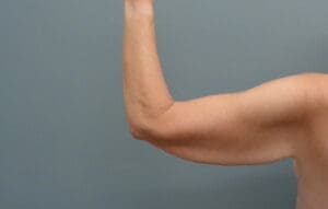 Before & After Pictures in Nashville, TN