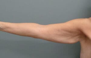 Before & After Pictures in Nashville, TN