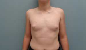 Before & After Pictures in Nashville, TN