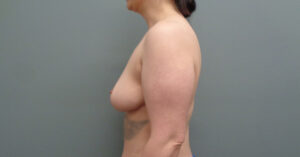 Before & After Pictures in Nashville, TN