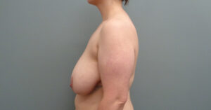 Before & After Pictures in Nashville, TN