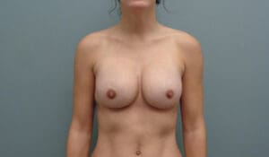 Before & After Pictures in Nashville, TN