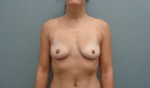 Before & After Pictures in Nashville, TN