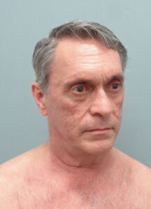 Before & After Pictures in Nashville, TN