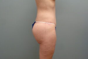 Before & After Pictures in Nashville, TN