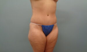 Before & After Pictures in Nashville, TN