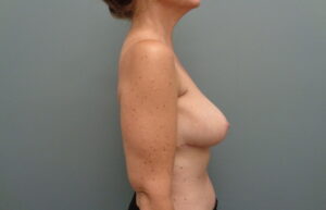 Before & After Pictures in Nashville, TN