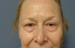 Before & After Pictures in Nashville, TN