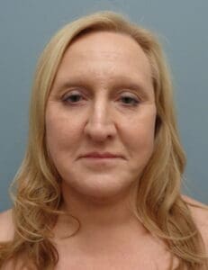 Before & After Pictures in Nashville, TN