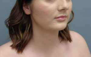 Before & After Pictures in Nashville, TN