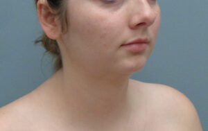 Before & After Pictures in Nashville, TN