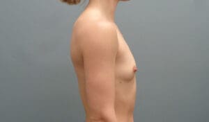 Before & After Pictures in Nashville, TN