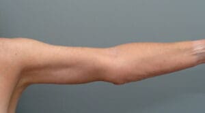 Before & After Pictures in Nashville, TN