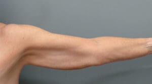 Before & After Pictures in Nashville, TN