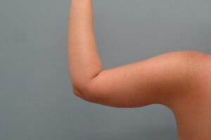 Before & After Pictures in Nashville, TN