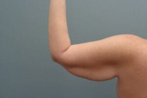 Before & After Pictures in Nashville, TN