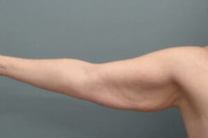 Before & After Pictures in Nashville, TN