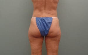 Before & After Pictures in Nashville, TN