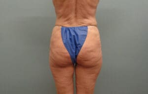 Before & After Pictures in Nashville, TN